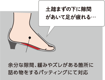 Q:土踏まずの下に隙間があいて足が疲れる… A:余分な隙間、緩みやズレがある箇所に詰め物をするパッティングにて対応