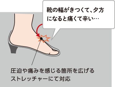 Q:靴の幅がきつくて、夕方になると痛くて辛い… A:圧迫や痛みを感じる箇所を広げるストレッチャーにて対応